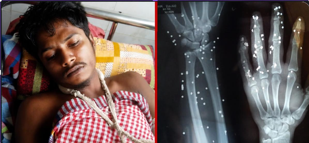 বন্ধুকে বাঁচাতে গিয়ে নিজে গুলি খেলেন রাফি: ৫ আগস্টের বিজয় মিছিলে তারুণ্যের নিঃস্বার্থ আত্মত্যাগের এক অনন্য উপাখ্যান